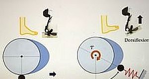 Putting the spring-cam back into stroke patients' steps