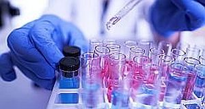 A new gold standard? Sputum testing provides higher rate of COVID-19 detection