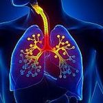 Bronchiolitis – Inflammation of the bronchioles