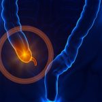 Appendix pain