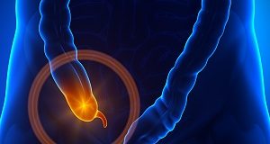 Antibiotics compared to surgery in treating appendicitis — Randomised trial