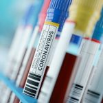 Coronavirus 2019-nCoV Blood Samples Medical Concept