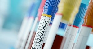 Over 80% of people testing positive were asymptomatic — University College London