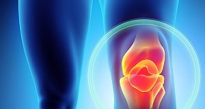 Younger knee replacement patients more likely to require re-operation