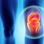 Knee painful – skeleton x-ray.