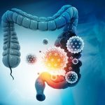 Colon cancer, bacteria, viruses in sick unhealthy intestine