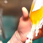 Transfusion of human plasma.