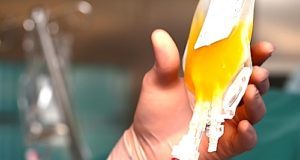 Early convalescent plasma may lower risk and progression of COVID in seniors — Argentine trial