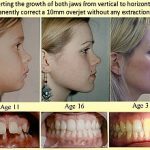 9-MB-Talking Points-07-01-2021-1-Photos-John Mew-Growth-direction-e1505809288443