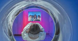 CT scan catches 70% of lung cancers at early stage — SUMMIT study