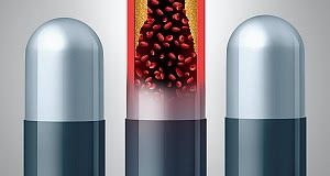 Statins found to have no effect on muscle pain in placebo trial