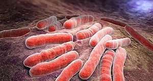 SA's first national TB prevalence survey: A bleaker picture than expected