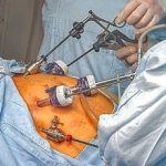 3-MB-Practitioners Must Read-08-04-2021-Bariatric surgery-iStock-508625853