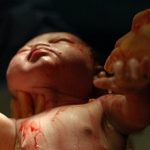4-MB-Editors Picks-08-04-2021-1-Child birth-Newborn-Caesarian birth-iStock-163183659