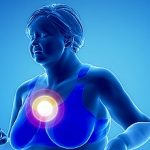 4-MB-Editors Picks-15-04-2021-Women-heart-iStock-611782688