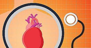 Experts urge action to reduce global burden of cardiovascular disease in women