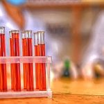 3-MB-Editors Picks-01-07-2021-1-Blood-Test-Tube-Lab-iStock-1201638466