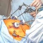 6-MB-Editors Picks-24-06-2021-Bariatric surgery-iStock-508625853