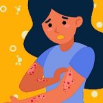 3-MB-Practitioners Must Read-29-07-2021-1-Skin-Rash-Psoriasis-iStock-1227136900