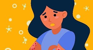 Simple dietary changes may have significant effect on psoriasis