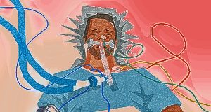 Severe traumatic brain injury: Don’t be too hasty in pulling the plug