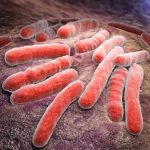 1-MB-Focus-21-10-2021-Tuberculosis-Mycobacterium-bacterial-TB-iStock-483787910