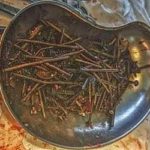15-MB-Lighter Note-07-10-2021-1-kilo of nails from stomach