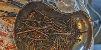 Man gives up drinking and instead binges on a kilo of assorted hardware