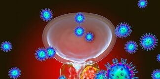 Urine biomarker to determine prognosis in prostate cancer – East Anglia study