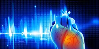 Mental stress-induced myocardial ischaemia significantly associated with CV death