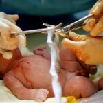 5-MB-Editors Picks-06-01-2022-Baby-Birth-Umbilical cord-iStock-168712974