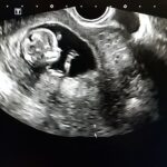 12-MB-Practitioners-17-02-2022-Prenatal-Ultrasound-foetus-iStock-1064299270