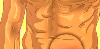 ‘Just a hernia’: The common operation with recurrence and complication rates stuck in the 1990s