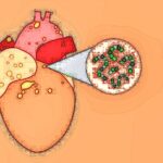 6-MB-Editors Picks-03-03-2022-3-Endocarditis-Heart-iStock-1270292481