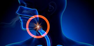 Sleep apnoea breathing pauses reduced with sulthiame – Swedish trial