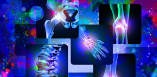 Vegan diet linked to fewer rheumatoid arthritis symptoms in women – Small study