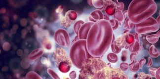 US cancer trial’s unexpected result: remission in every patient