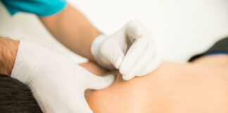 ‘Dry needling’ and acupuncture: what’s the difference, what’s the evidence?