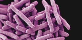 UWC study explores common carbohydrate as treatment for TB