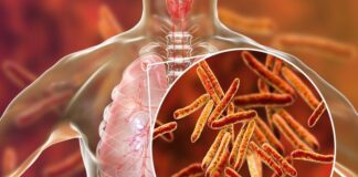 Big Tobacco link sees high-profile delegates pull out of SA TB conference