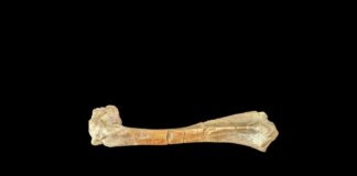 Stone Age surgical find shows limb amputation from 31 000 years ago