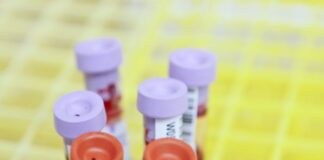 Blood test spots ‘toxic’ protein years before Alzheimer’s signs – US study