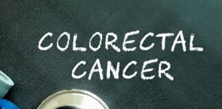 US team designs novel mapping of colorectal cancer