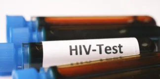Should we be concerned about HIV variants?