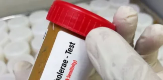 Unsafe national water supply sparks fears of larger cholera spread