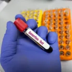 Blood sample for Gonorrhea test at medical laboratory. To diagnosis Syphilis and Gonorrhea disease