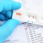 HIV positive test result
