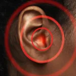 Audiol 1