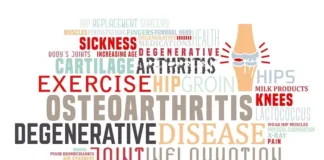 Osteoarthritis to affect 1bn people by 2050, predicts global study
