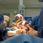 UK women undergo simultaneous Caesarean and cancer surgery